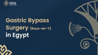 Gastric Bypass Surgery in Egypt