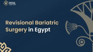 Revisional Bariatric Surgery in Egypt