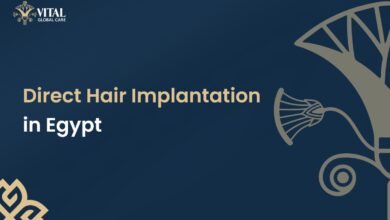 Direct Hair Implantation in Egypt