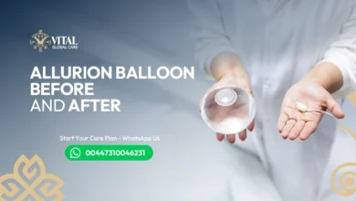 Allurion Balloon Before and After Cost vs. Weight Loss Value