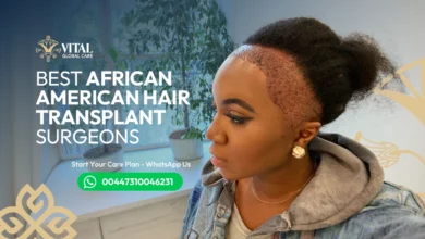 Best African American Hair Transplant Surgeons - Top list