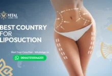 Best Country for Liposuction Global Ranking & Top 5