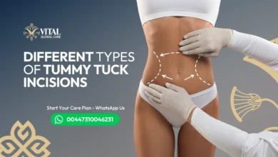 Different types of tummy tuck incisions – Complete Guide
