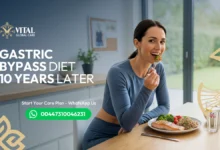 Gastric Bypass Diet 10 Years Later - Long-Term Results UK