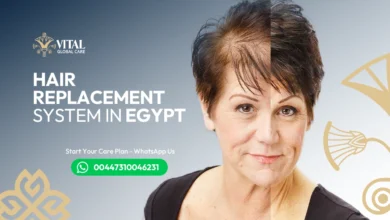 Hair Replacement System in Egypt - Undetectable Look