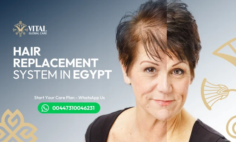 Hair Replacement System in Egypt - Undetectable Look