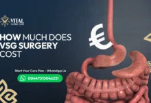 How much does VSG surgery cost Full Breakdown