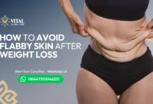 How to Avoid Flabby Skin After Weight Loss - Expert Tips UK