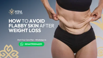 How to Avoid Flabby Skin After Weight Loss - Expert Tips UK