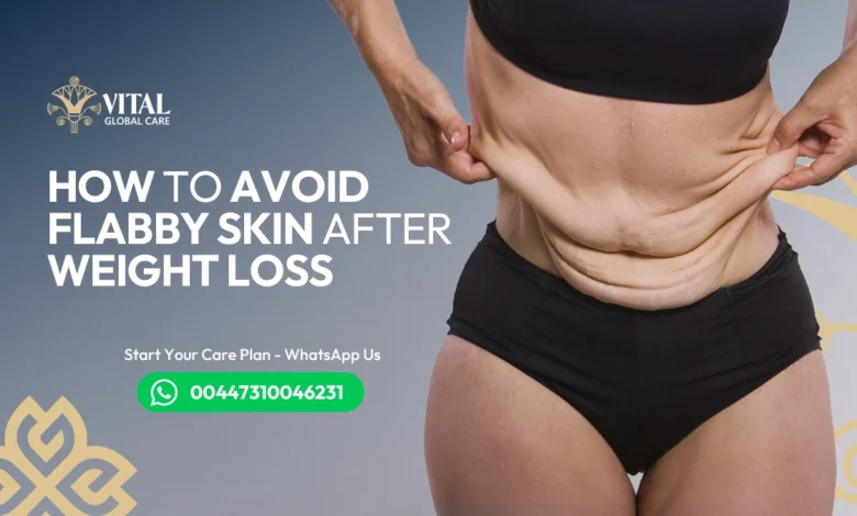 How to Avoid Flabby Skin After Weight Loss - Expert Tips UK