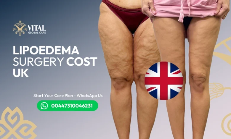 Lipoedema Surgery Cost UK​ - Full Price Breakdown