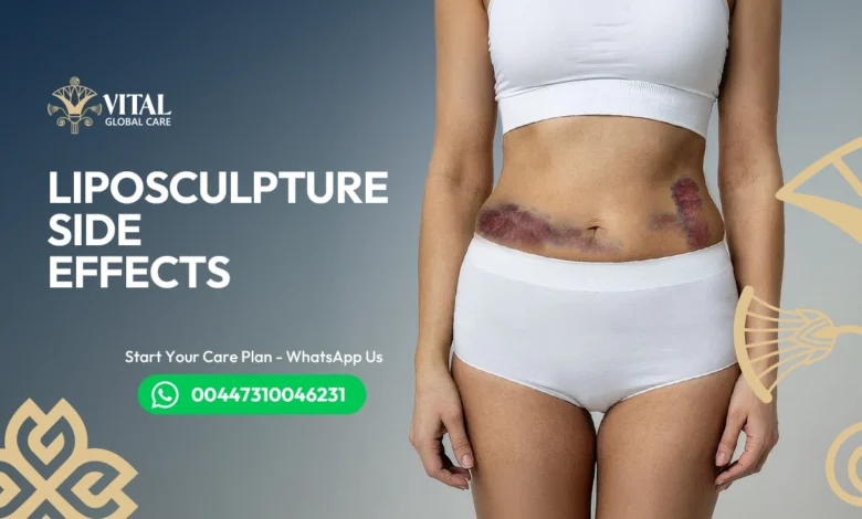 Liposculpture Side Effects UK - What to Expect After Surgery