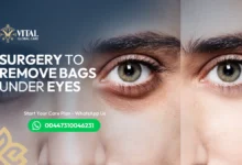 Surgery to Remove Bags Under Eyes: Permanent Solution Guide
