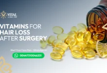Vitamins for hair loss after surgery Fast, Proven Fix
