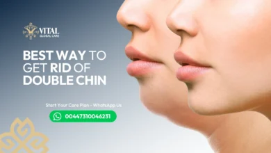 Best Way to Get Rid of Double Chin - Doctor-Approved Methods