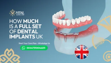 How much is a full set of dental implants uk​