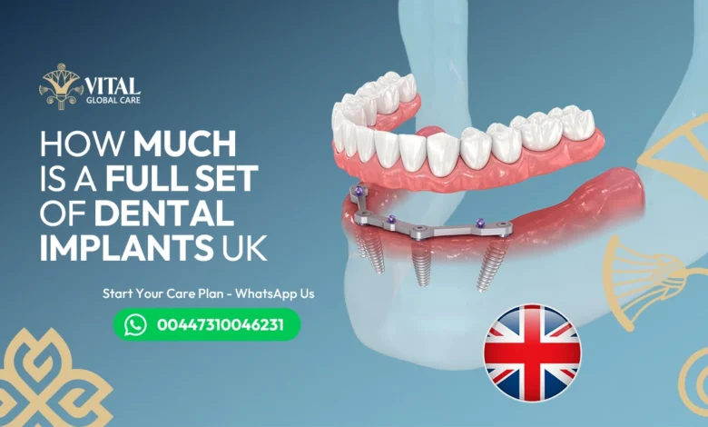How much is a full set of dental implants uk​