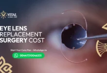 Is Eye Lens Replacement Surgery Cost Worth It? (Guide)