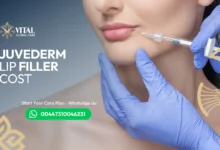 Juvederm Lip Filler Cost - Ultimate Price Guide 2025