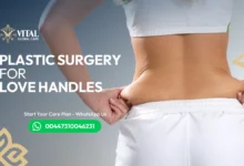 Plastic surgery for love handles - Lipo vs Tummy Tuck