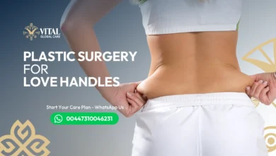 Plastic surgery for love handles - Lipo vs Tummy Tuck