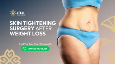 Skin Tightening Surgery After Weight Loss - The Guide