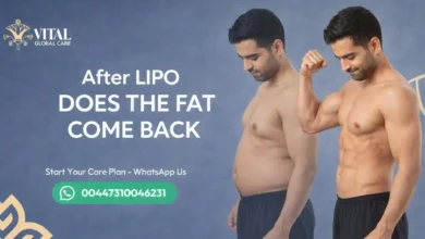 After Lipo Does the Fat Come Back - The Truth Revealed