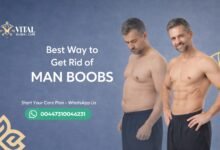 Best Way to Get Rid of Man Boobs - Surgery vs. Natural