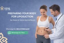 How Do I Prepare My Body for Liposuction - Vital Steps
