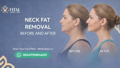Visible Changes - Neck Fat Removal Before and After Guide