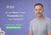 Do You Have to Take Finasteride After Hair Transplant