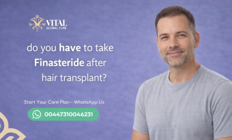 Do You Have to Take Finasteride After Hair Transplant