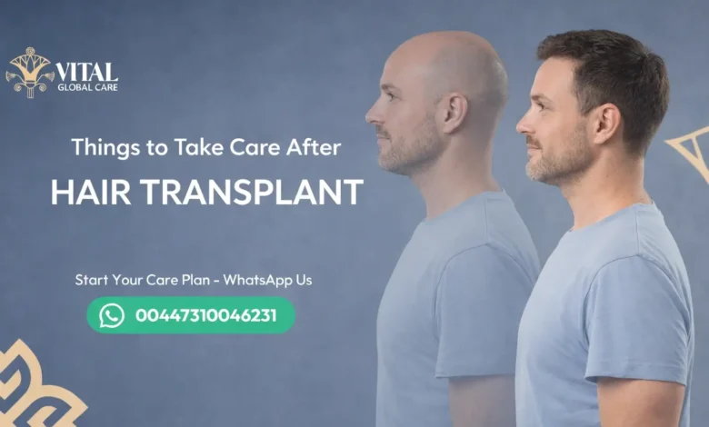 Vital Things to Take Care After Hair Transplant Surgery
