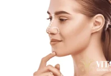 Find the Best Non Surgical Rhinoplasty Near Me Safely