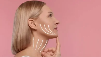 Where Are the Incisions Made for a Facelift - 2026 Techniques