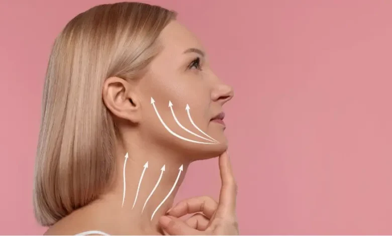 Where Are the Incisions Made for a Facelift - 2026 Techniques